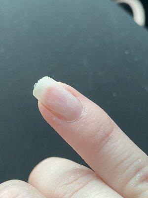 Burnt nail