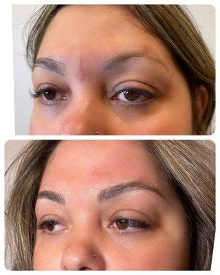 Over the years she over plucked her eyebrows and now she wants them back fuller ! #microbladedbrows