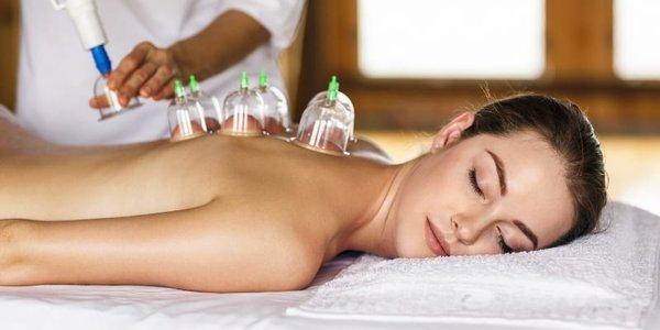 Cupping Therapy