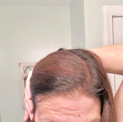 Forehead staining a day later. Patchy coloring- black roots