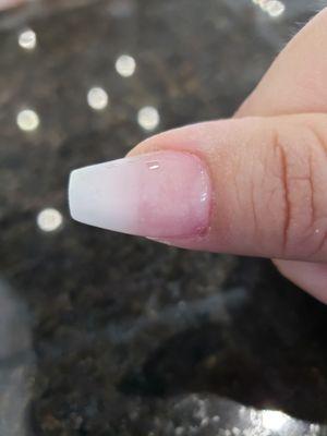 Choppy transition and ruined dry cuticles