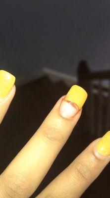 2 weeks after I got the yellow set done in the other pic, my nail cracked underneath.