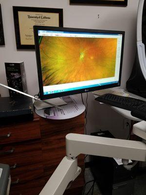 There's an image of my eye! State-of-the-art optos visualizing program.