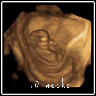 10 weeks