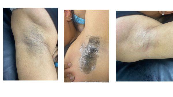 Underarm Wax