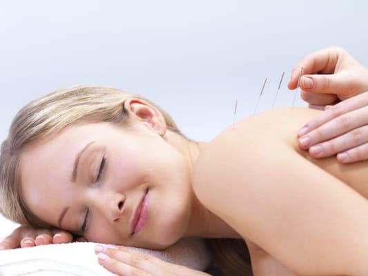 Acupuncture is available at Essentials on Mon, Wed and Sat (by appointment only)