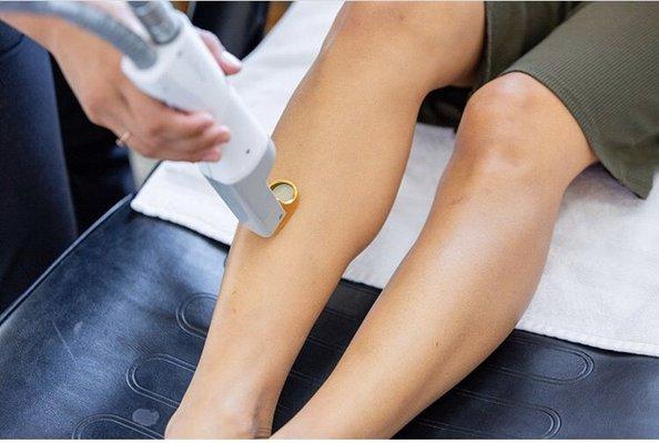 Laser Hair Removal