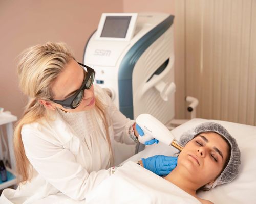 ResurFX Fractional laser rejuvenation