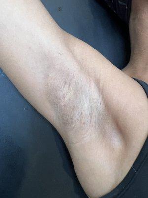 'After' underarm wax