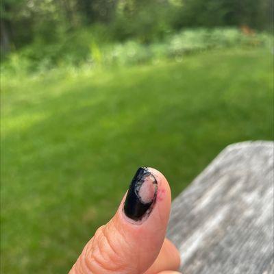 Butchered nail and skin