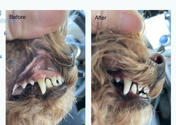 Before & after dental cleaning.