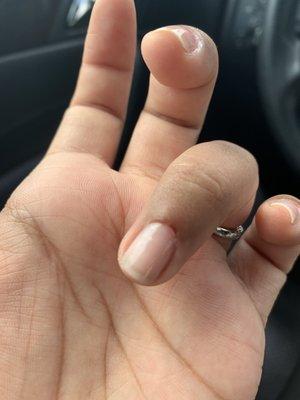 Horrible cuticle cutting