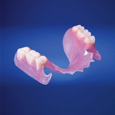 New flexible, metal free partial dentures