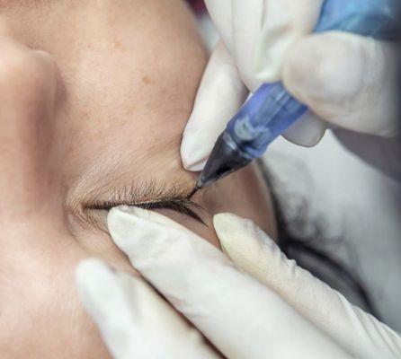 During permanent eyeliner procedure