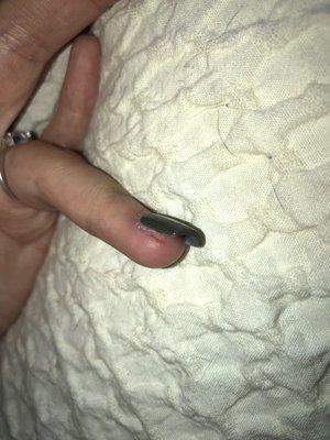 this is the cut that hurts the most- i have another one on my other ring finger too