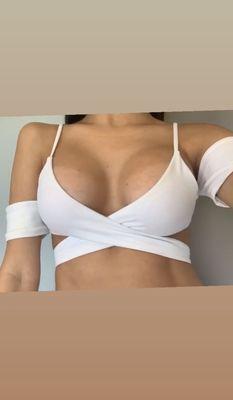 Breast Augmentation Houston