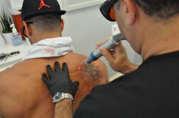 ReversaTatt Tattoo Removal