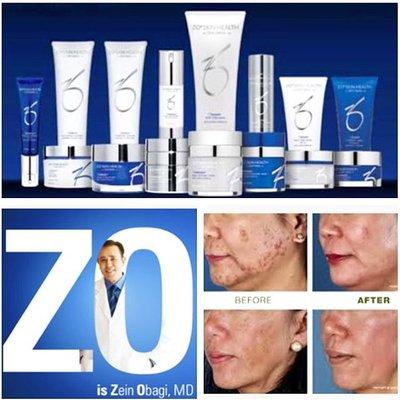 ZO by Obagi Skincare and Chemical Peels