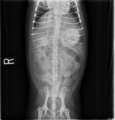 X-ray of blockage