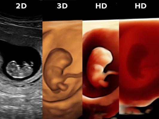 Amazing images at 9 weeks!