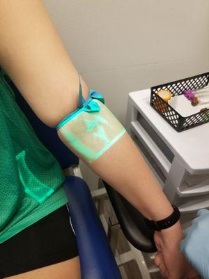 The technology for scanning veins is pretty cool.