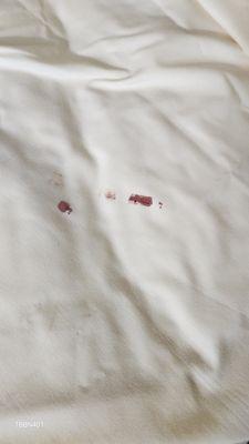 Dry blood in sheets