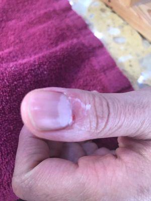 My boyfriends cuticles