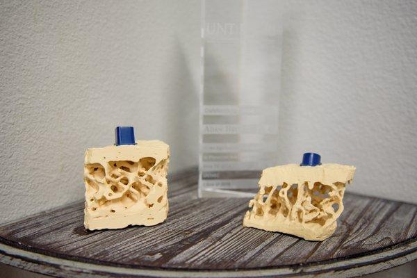 Osteoporatic bone models