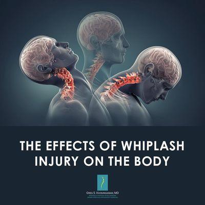 The stiffness and pain from whiplash may affect your neck for days, months, or even years. Call us at (747) 254-0163