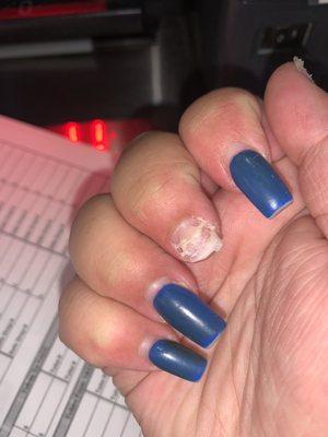 Broken cut nail