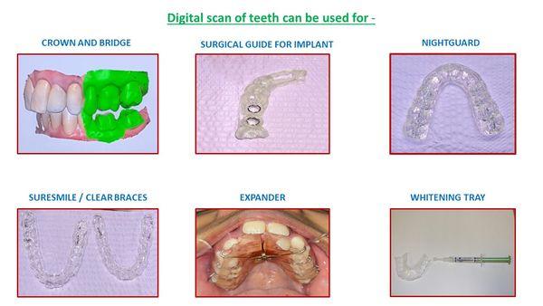 Digital scanner uses -