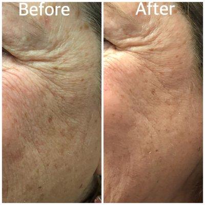 Age-smart facial treatment