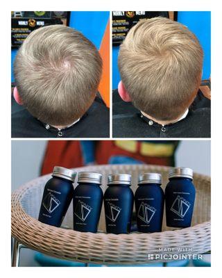 Less dense up top? NO PROBLEM! INFINITY HAIR FIBERS