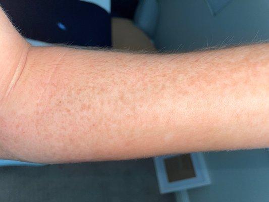 Versa Spa Pro Spray Tan Results