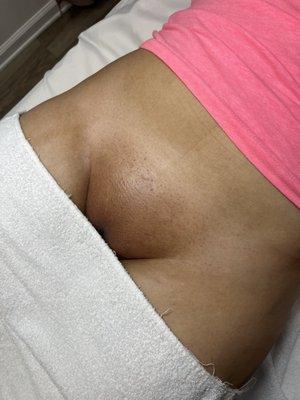 Brazilian sugaring