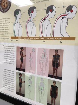 Bad Posture Creates Stress On Your Spine, Joints, And Nerves