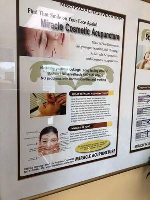 Cosmetic acupuncturist