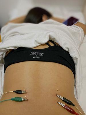 The commonly seen - lower back pain. Acupuncture and electric stimulation will do the trick!