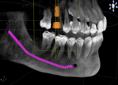 3D View of a CBCT scan