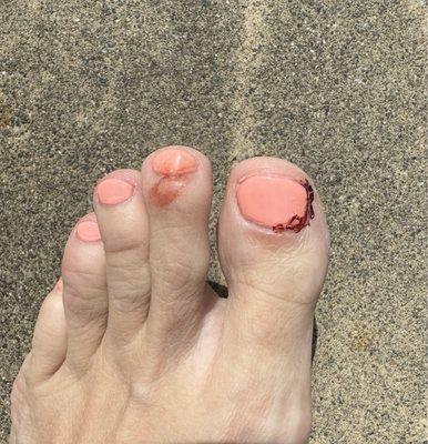 I left with two bloody toes after a pedicure.