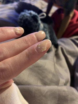 Cracked nail