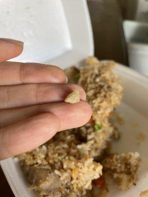 THERE WAS A FREAKING ROCK IN MY RICE!