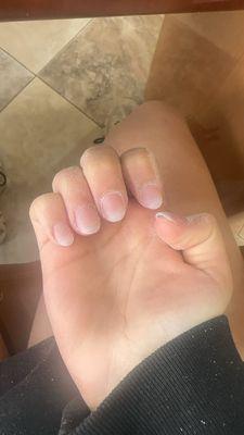 horrible nails