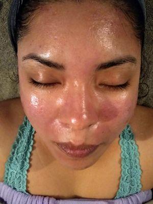 Denise's Skin Spa