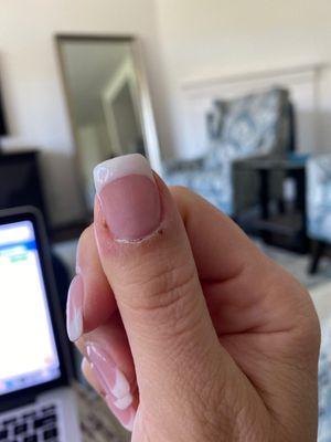 Cut on thumb