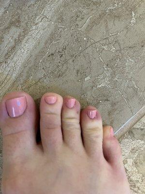 Lack of toe separators makes smudges