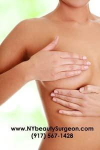 Breast Lift, liposuction