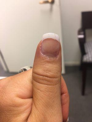 Nail 2 days after fill - completely peeling off and chipping.