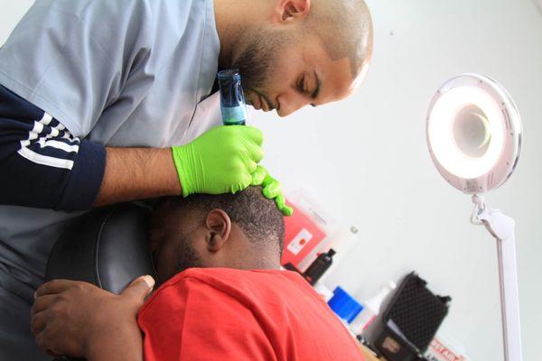 Scalp Micropigmentation Density fill