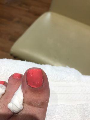 Toe